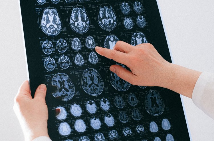 THS Therapie psychischer Erkrankungen